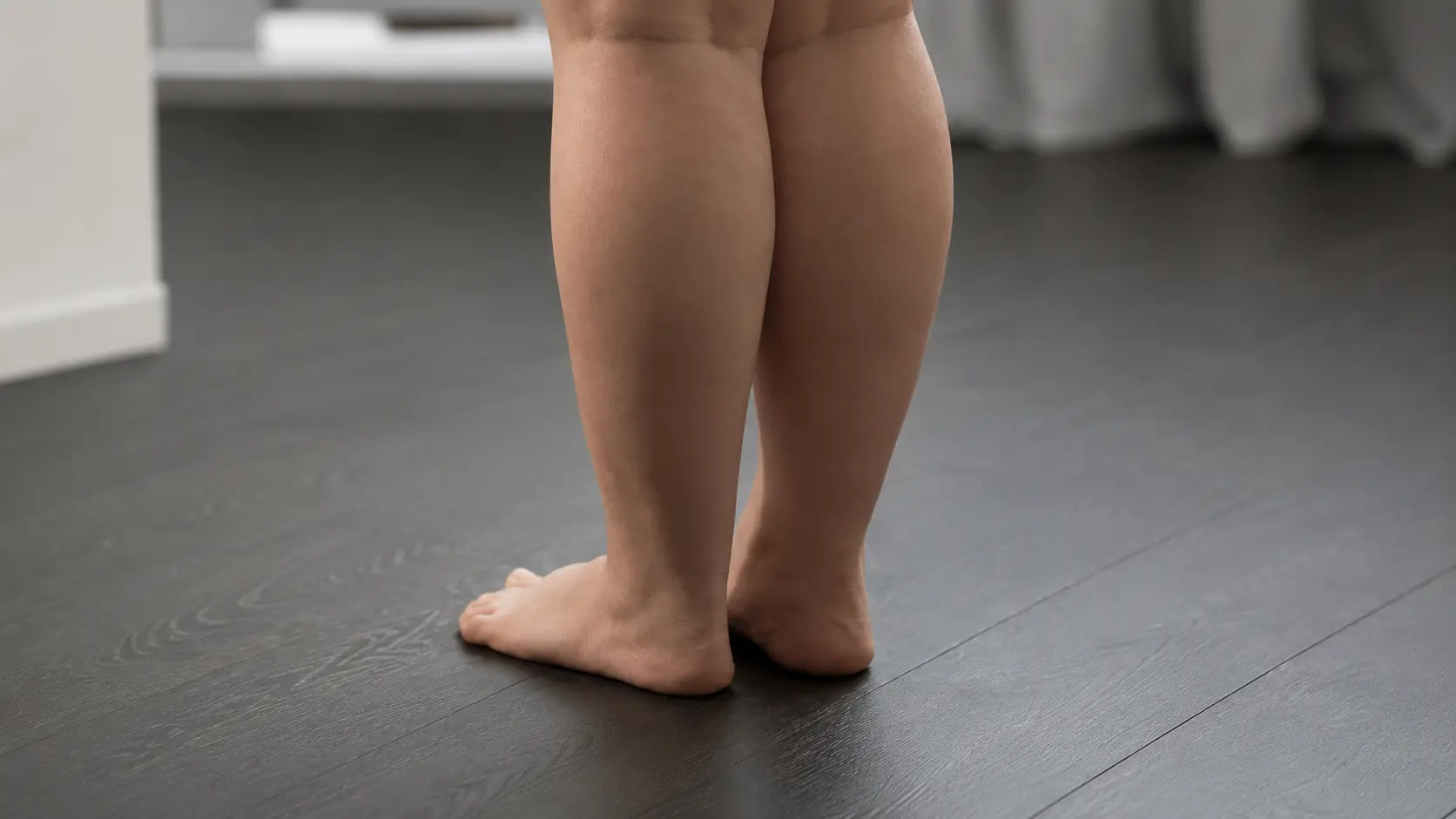 Both legs showing cankles where the calf blends into the ankle without a clear line